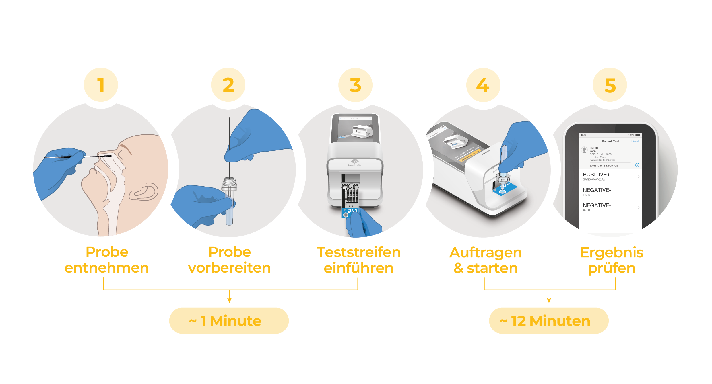 SARS Flu Master Workflow DE